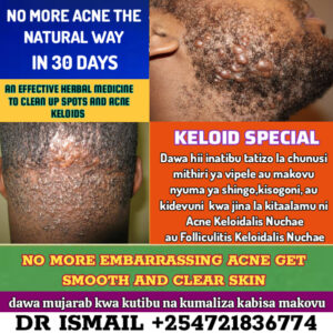 KELOIDS OIL