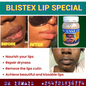 BLISTEX LIP SPECIAL
