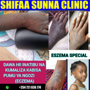 ECZEMA SPECIAL PACKAGE