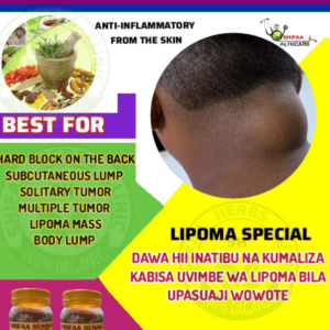 LIPOMA SPECIAL