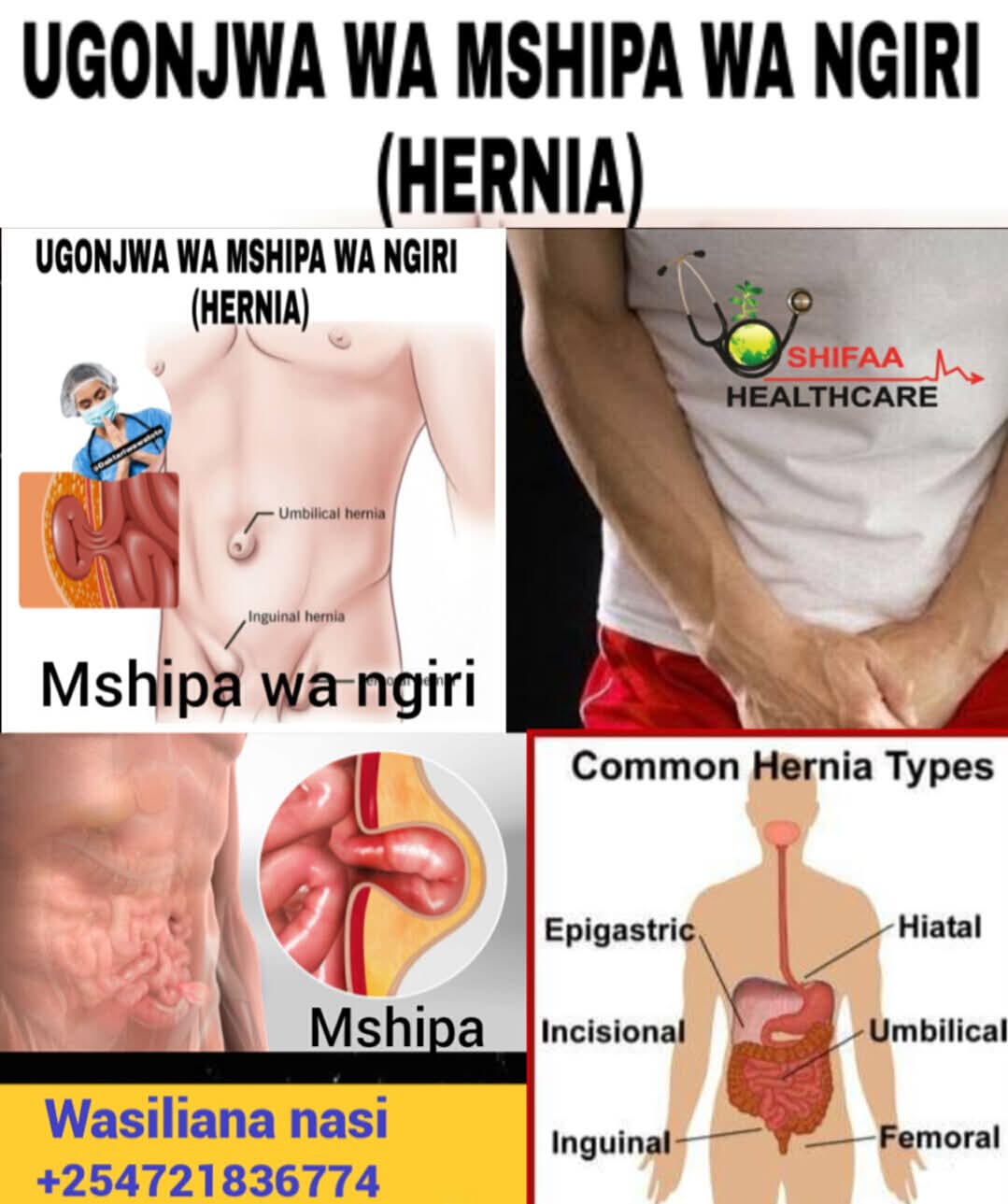 HERNIA CARE - Image 4