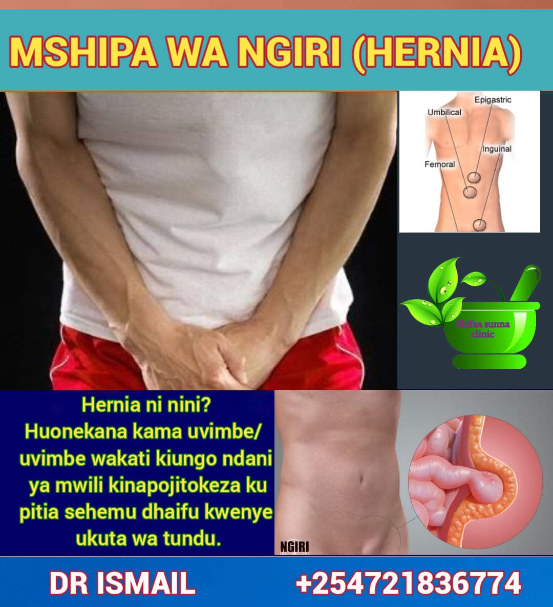 HERNIA CARE - Image 3