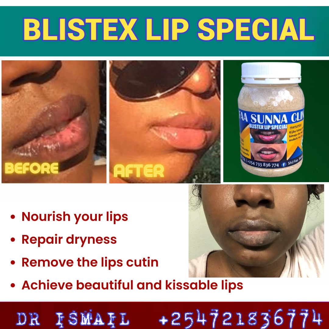 BLISTEX LIP SPECIAL - Image 2