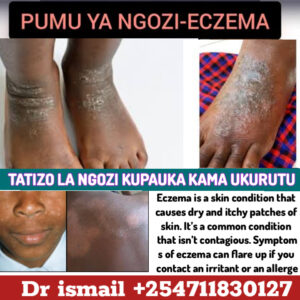 ESZEMA SPECIAL