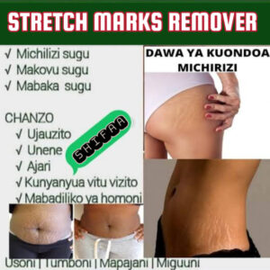 STRETCH MARKS REMOVER