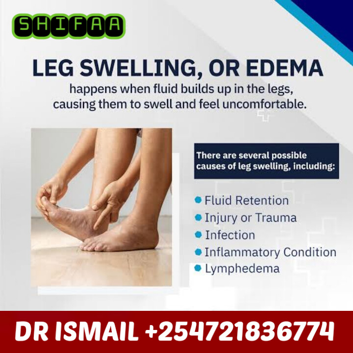 EDEMA SOLUTION - Image 4