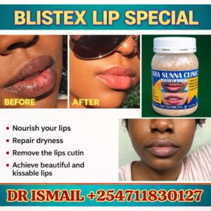 BLISTEX LIP SPECIAL