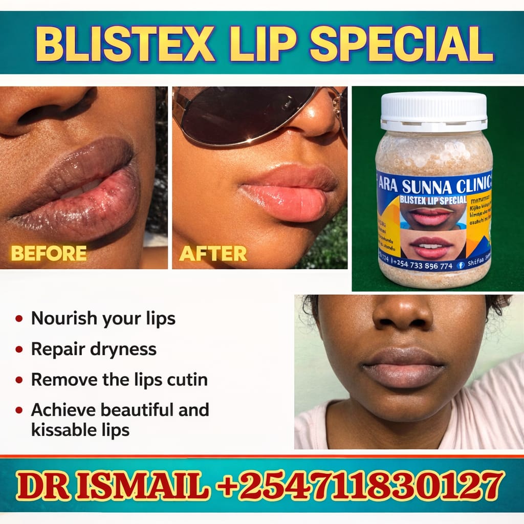 BLISTEX LIP SPECIAL