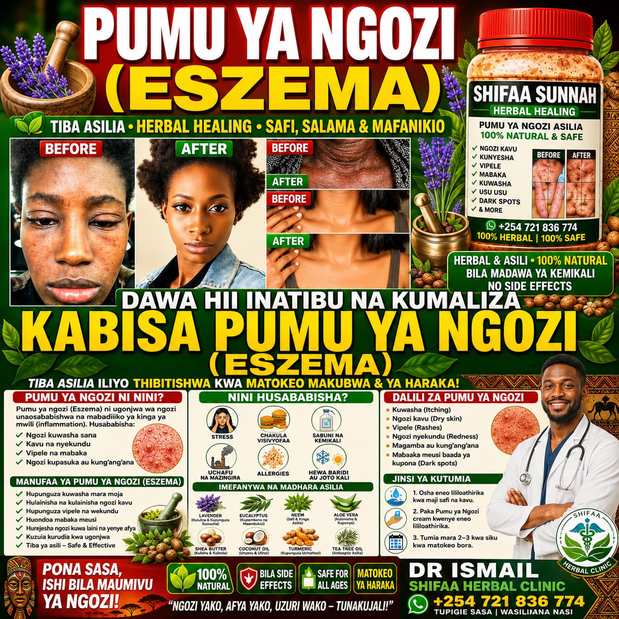 ESZEMA SPECIAL