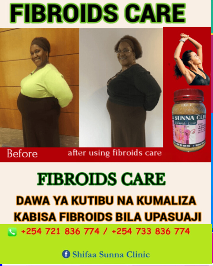 FIBROIDS CARE - Image 3