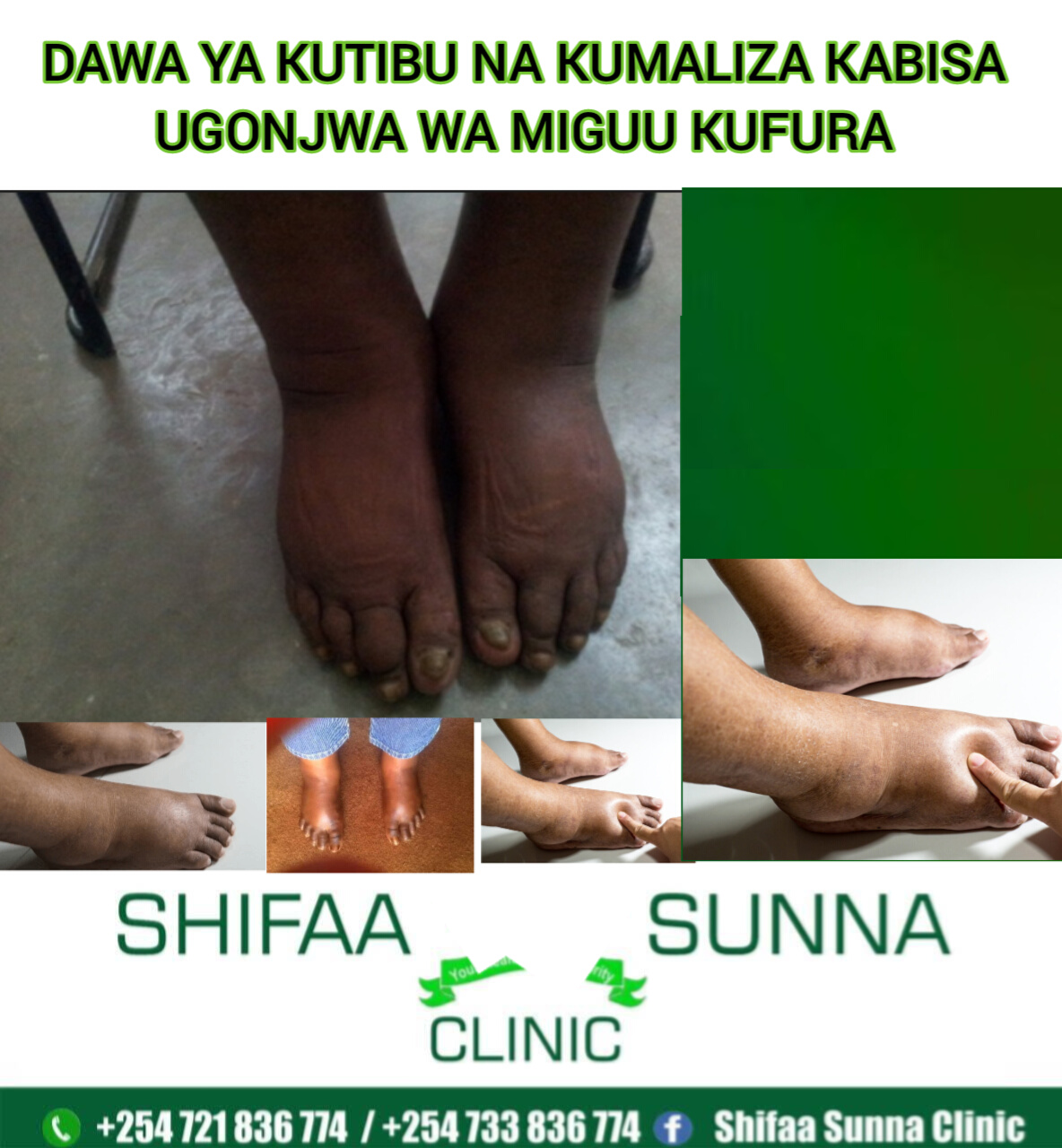 EDEMA SOLUTION - Image 3