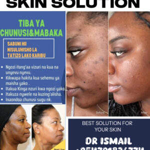 SKIN SOLUTION