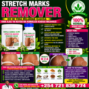 STRETCH MARKS REMOVER