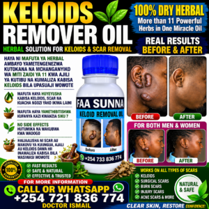 KELOIDS REMOVER OIL