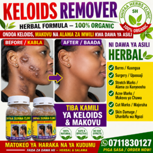 KELOIDS REMOVER