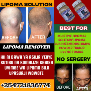 LIPOMA SPECIAL