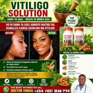 VITILIGO SOLUTION