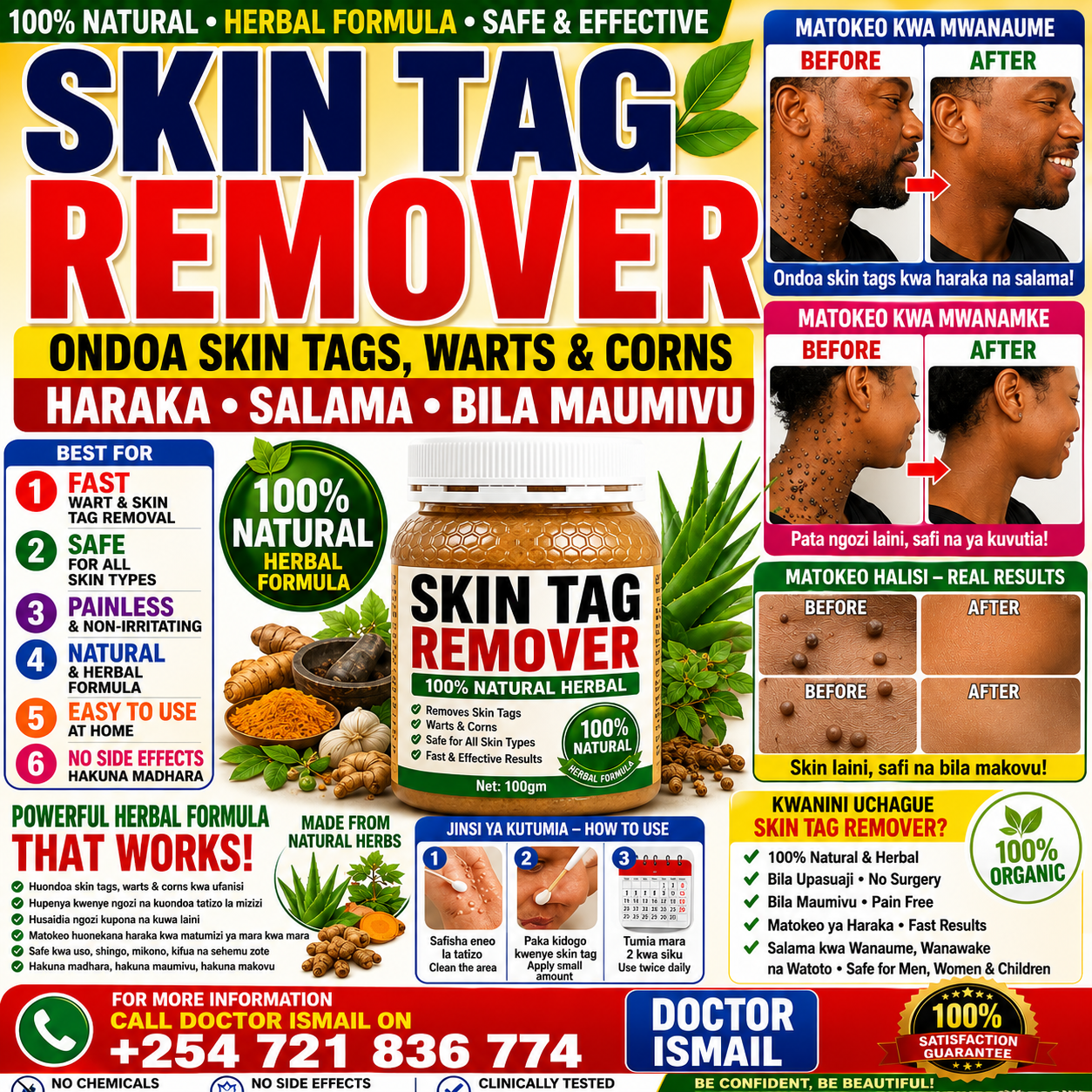 SKIN TAGS REMOVER