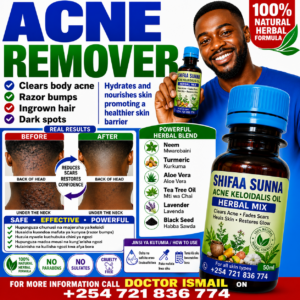 KELOIDS SPECIAL OIL